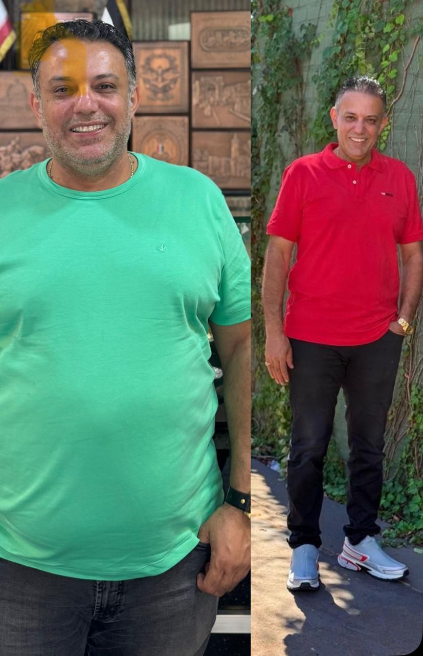 Antes e depois do Protocolo Slim 8